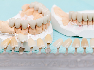 stomatoloska protetika