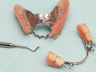 stomatoloska protetika